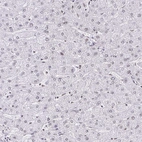 Immunohistochemical staining of human liver shows no positivity in hepatocytes as expected.