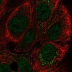 Anti-CCDC144A Antibody