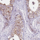 Anti-UTP14C Antibody