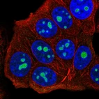 Immunofluorescent staining of human cell line MCF7 shows localization to nucleoli.