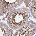Immunohistochemical staining of human testis shows strong cytoplasmic positivity in late spermatids.