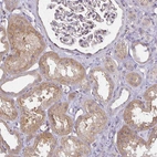 Immunohistochemical staining of human kidney shows moderate cytoplasmic positivity in cells in tubules.