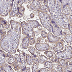 Immunohistochemical staining of human placenta shows moderate cytoplasmic positivity in trophoblastic cells.