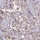 Immunohistochemical staining of human placenta shows moderate cytoplasmic positivity in trophoblastic cells.