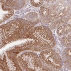 Anti-FAM196B Antibody