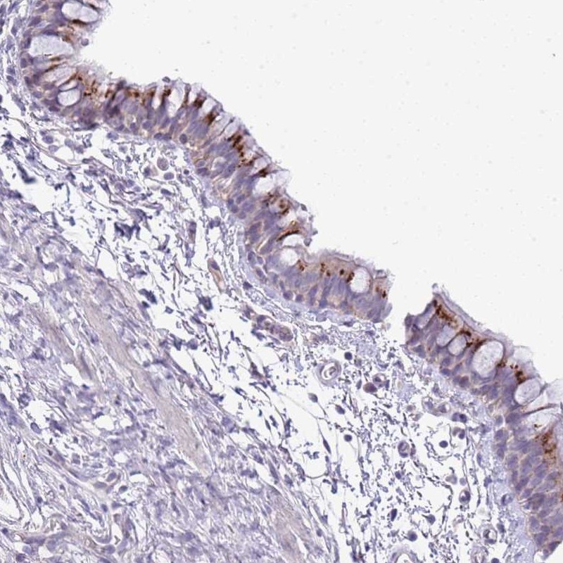 Anti-ABHD17A Antibody