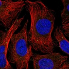Immunofluorescent staining of human cell line U-2 OS shows localization to vesicles.
