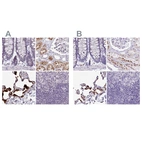Immunohistochemical staining of human colon, kidney, lung and lymph node using Anti-NAPSA antibody HPA047236 (A) shows similar protein distribution across tissues to independent antibody HPA045280 (B).