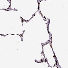 Immunohistochemical staining of human lung shows high expression.