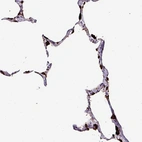 Immunohistochemical staining of human lung shows high expression.
