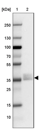 Lane 1: Marker [kDa] 250, 130, 100, 70, 55, 35, 25, 15, 10_br/_Lane 2: Human Lung tissue