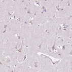 Immunohistochemical staining of human cerebral cortex shows weak granular cytoplasmic positivity in neurons.