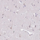 Immunohistochemical staining of human cerebral cortex shows weak granular cytoplasmic positivity in neurons.