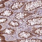 Immunohistochemical staining of human colon shows strong granular cytoplasmic positivity in glandular cells.