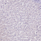 Immunohistochemical staining of human liver shows no positivity in hepatocytes as expected.