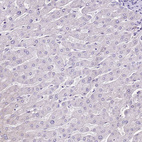 Anti-MRPL36 Antibody