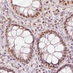 Immunohistochemical staining of human colon using Anti-PPP1R10 antibody HPA047248.