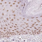 Immunohistochemical staining of human skin using Anti-PPP1R10 antibody HPA047248.