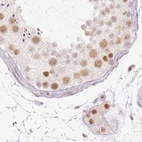 Immunohistochemical staining of human testis using Anti-PPP1R10 antibody HPA047248.