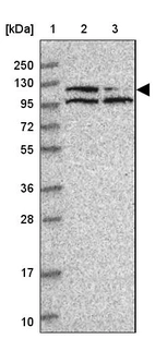 Lane 1: Marker [kDa] 250, 130, 95, 72, 55, 36, 28, 17, 10_br/_Lane 2: Human cell line RT-4_br/_Lane 3: Human cell line U-251 MG