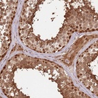 Anti-PLSCR5 Antibody