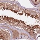 Anti-GPR180 Antibody