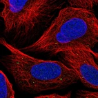 Immunofluorescent staining of human cell line U-2 OS shows localization to vesicles.