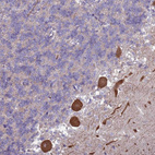 Immunohistochemical staining of human cerebellum shows strong cytoplasmic positivity in Purkinje cells.
