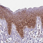 Immunohistochemical staining of human Skin shows moderate cytoplasmic positivity in squamous epithelial cells.