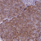 Immunohistochemical staining of human pancreas shows moderate cytoplasmic positivity in exocrine glandular cells.