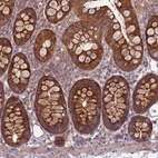 Immunohistochemical staining of human Colon shows strong cytoplasmic positivity in glandular cells.