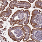 Immunohistochemical staining of human small intestine shows moderate cytoplasmic positivity in glandular cells.