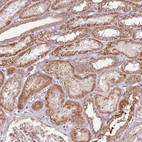 Immunohistochemical staining of human Kidney shows moderate granular cytoplasmic positivity in cells in tubules.