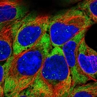Immunofluorescent staining of human cell line HEK 293 shows localization to nucleoli fibrillar center, cytosol & endoplasmic reticulum.