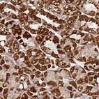 Anti-TMEM200C Antibody