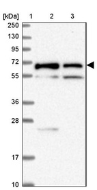Lane 1: Marker [kDa] 250, 130, 95, 72, 55, 36, 28, 17, 10_br/_Lane 2: Human cell line RT-4_br/_Lane 3: Human cell line U-251MG sp