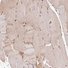 Anti-PIH1D1 Antibody