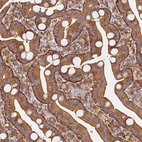 Immunohistochemical staining of human duodenum shows strong cytoplasmic-membranous positivity in glandular cells.