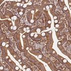 Immunohistochemical staining of human duodenum shows strong cytoplasmic-membranous positivity in glandular cells.