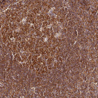 Immunohistochemical staining of human tonsil shows strong cytoplasmic positivity in germinal center cells and non-germinal center cells.