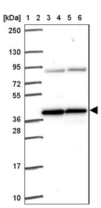 Lane 1: Marker [kDa] 250, 130, 95, 72, 55, 36, 28, 17, 10_br/_Lane 2: Human cell line RT-4_br/_Lane 3: Human cell line U-251 MG_br/_Lane 4: Human plasma_br/_Lane 5: Human Liver tissue_br/_Lane 6: Human Tonsil tissue