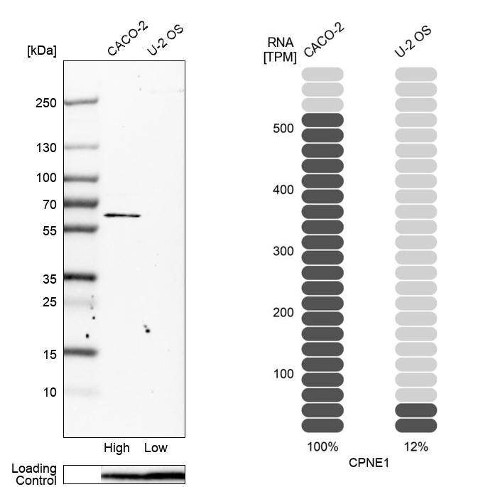 Anti-CPNE1 Antibody