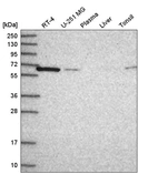 Western blot analysis in human cell line RT-4, human cell line U-251 MG, human plasma, human liver tissue and human tonsil tissue.