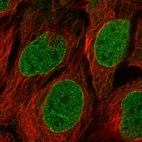Immunofluorescent staining of human cell line CACO-2 shows localization to nucleoplasm & nuclear membrane.