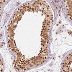 Anti-CSTF1 Antibody