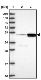 Lane 1: Marker [kDa] 250, 130, 95, 72, 55, 36, 28, 17, 10_br/_Lane 2: Human cell line RT-4_br/_Lane 3: Human cell line U-251MG sp