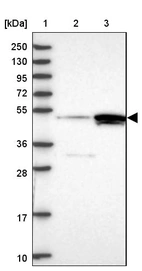 Lane 1: Marker [kDa] 250, 130, 95, 72, 55, 36, 28, 17, 10_br/_Lane 2: Human cell line RT-4_br/_Lane 3: Human cell line U-251MG sp