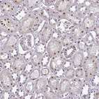 Immunohistochemical staining of human kidney shows moderate nuclear positivity in cells in tubules.