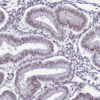 Immunohistochemical staining of human endometrium shows weak nuclear positivity in glandular cells.
