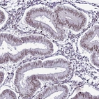 Immunohistochemical staining of human endometrium shows weak nuclear positivity in glandular cells.